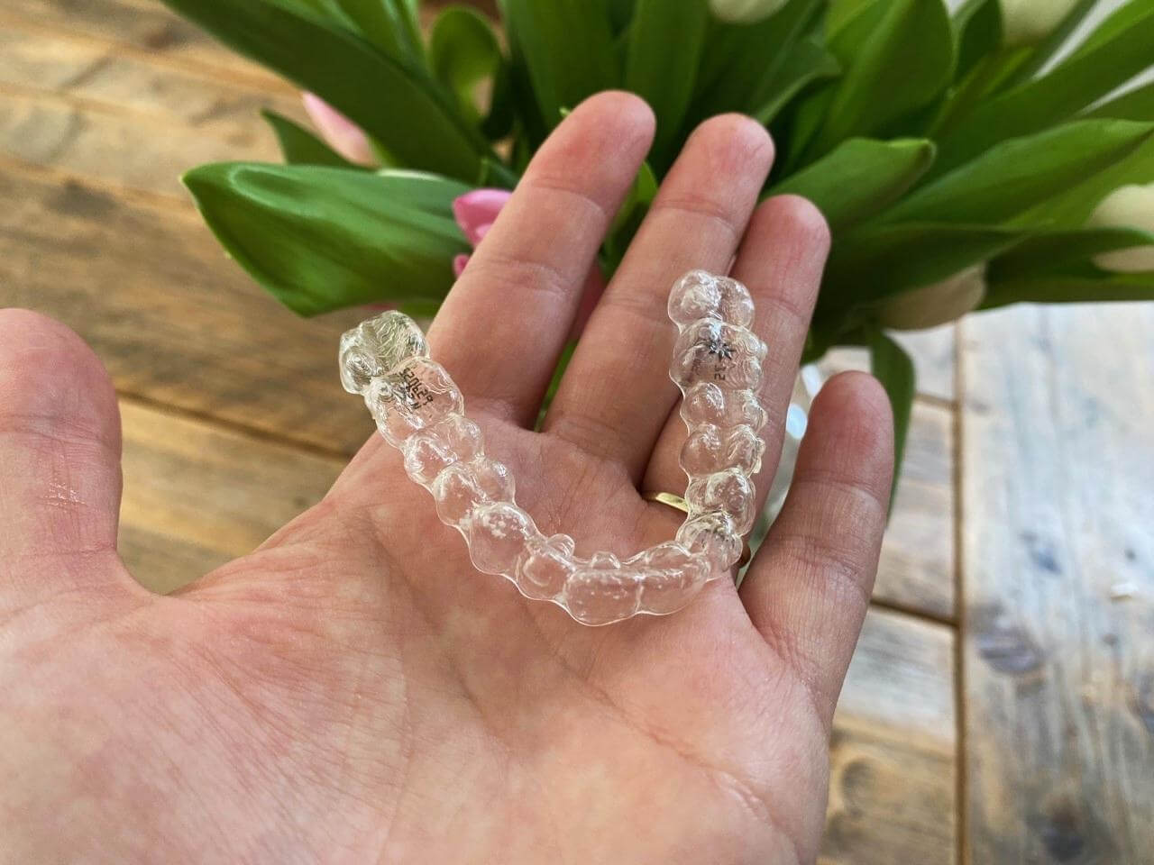 ervaringen invisalign