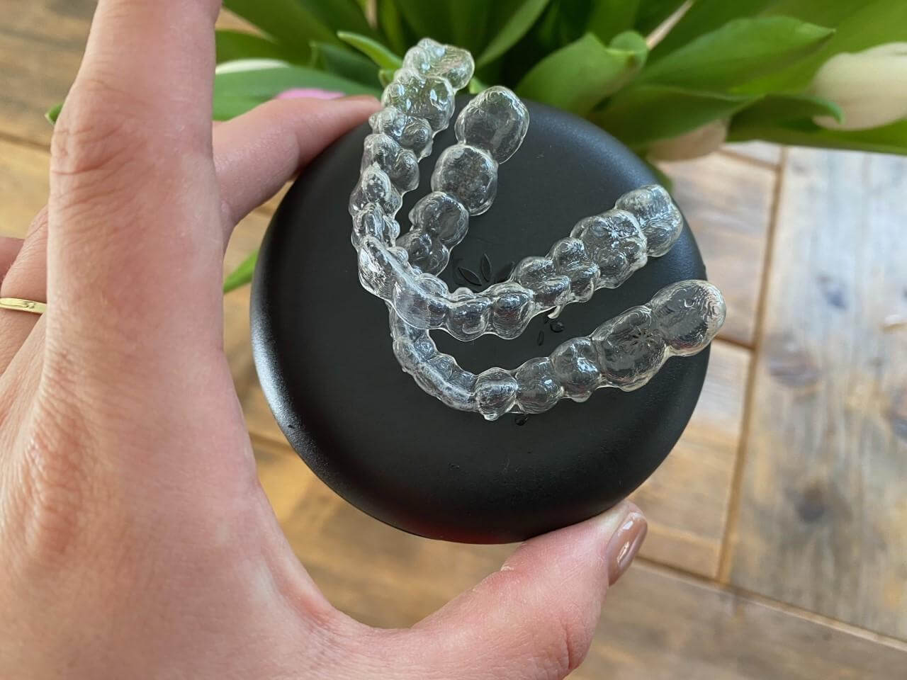 invisalign ervaringen